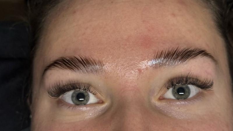 Sourcils relevés et disciplinés après un browlift réalisé chez Maison Marine